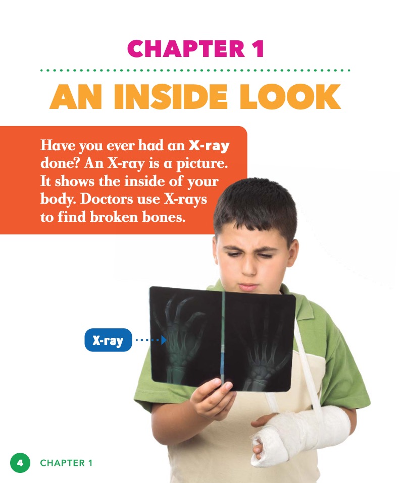 Medical Breakthroughs: X-Rays — page 1