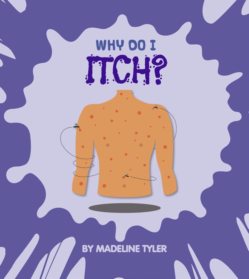 Why Do I Itch? book cover